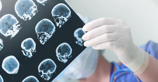 Primeiro atlas detalhado do cérebro humano é criado por cientistas americanos - H.Pro